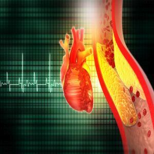 Neuroscience Heart and Stroke 2024 CNE Nursing Conference