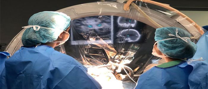 Stereotactic Functional Neuroanatomy Applied to Movement Disorders, Epilepsy, and Pain 2023