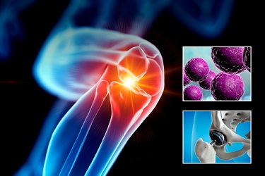 Orthopedic Infectious Diseases - LIVESTREAM