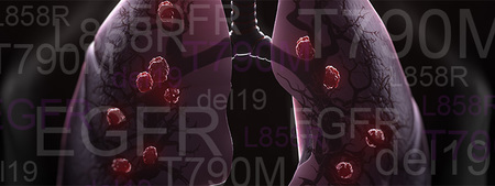 Tailoring Treatment of EGFR-Mutated NSCLC to Improve Patient Care, Oct 24