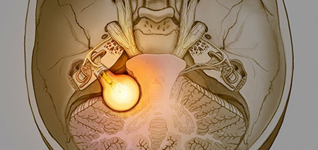 Vestibular Schwannoma Conference 2019