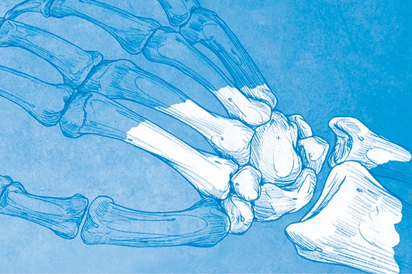 Controversies in Wrist Surgery